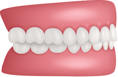 Custom Smile Design | Orthodontics by Bradford